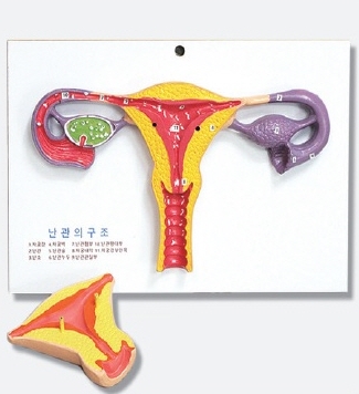 난관의 구조모형(분리형)